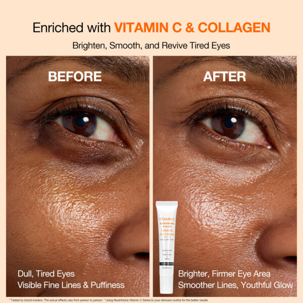 Vitamin C eye cream