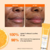 Vitamin C lip cream