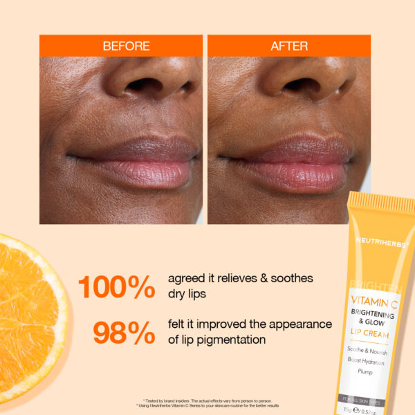 Vitamin C lip cream