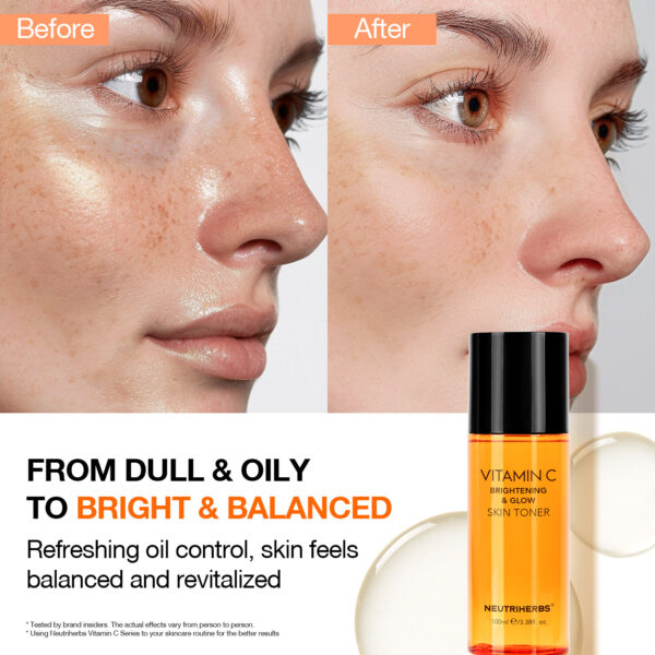 Vitamin C toner