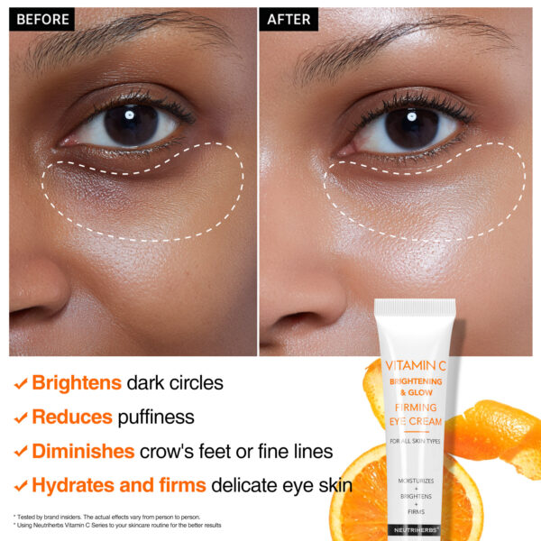 Vitamin C eye cream