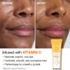 Vitamin C lip cream