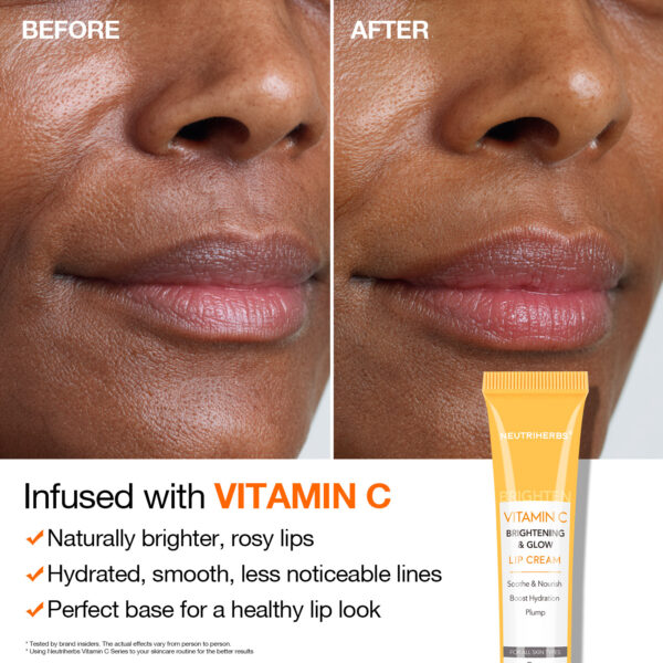 Vitamin C lip cream