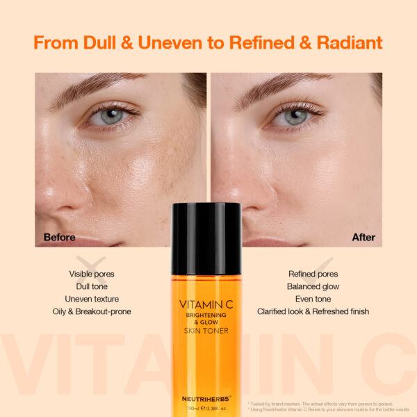 Vitamin C toner
