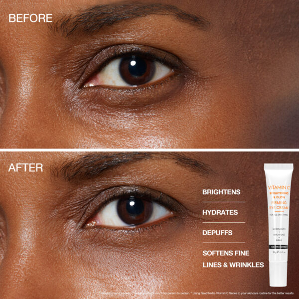 Vitamin C eye cream