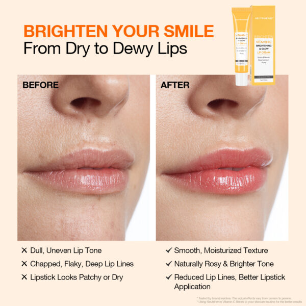 Vitamin C lip cream