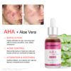 AHA serum