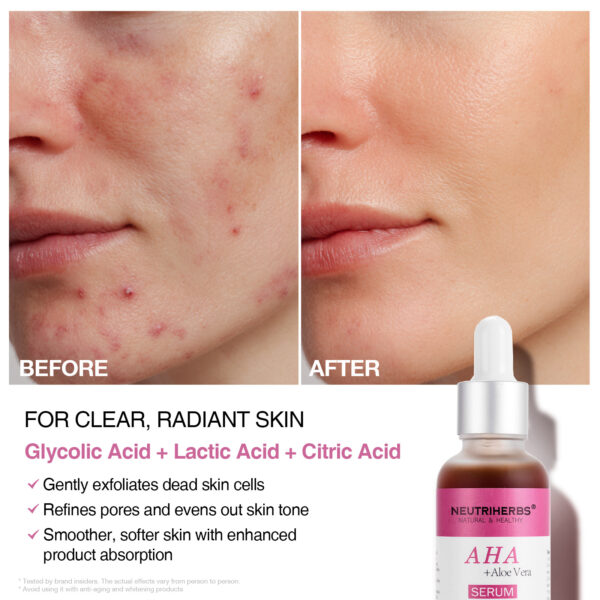 AHA serum