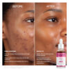 AHA serum