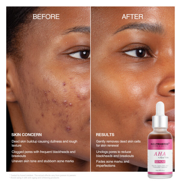 AHA serum