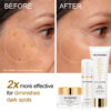 Lighten skin series