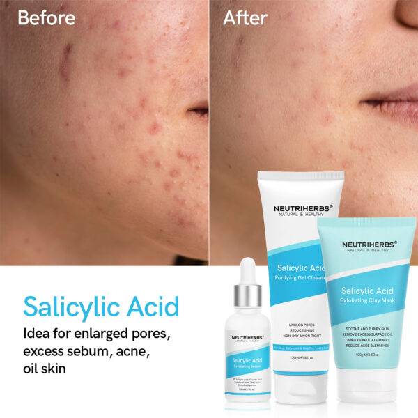 Salicylic treatment series