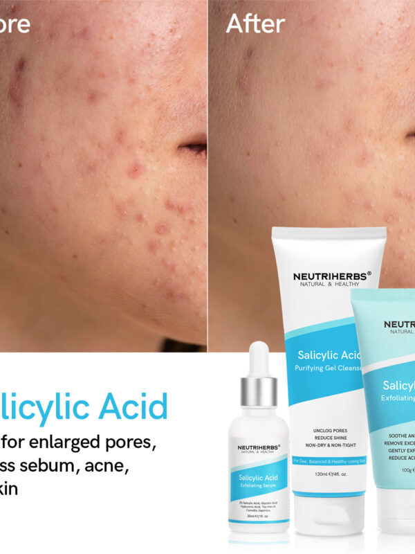 Salicylic treatment series